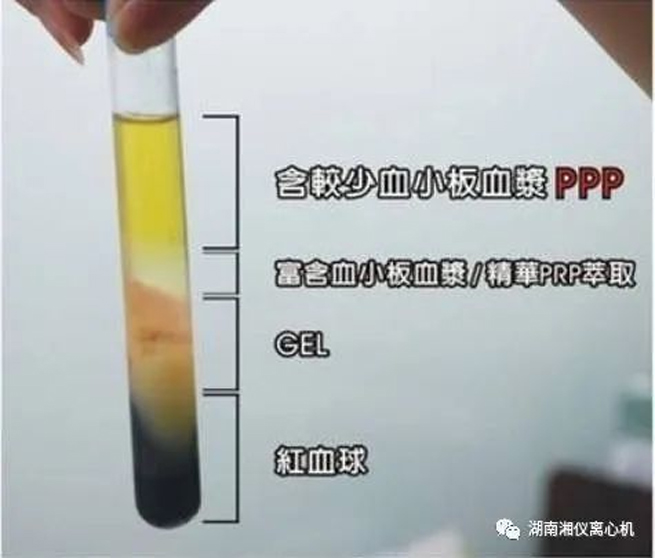 【Science Popularization】 PRP Autologous Serum Beauty