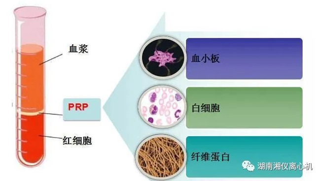 【Science Popularization】 PRP Autologous Serum Beauty